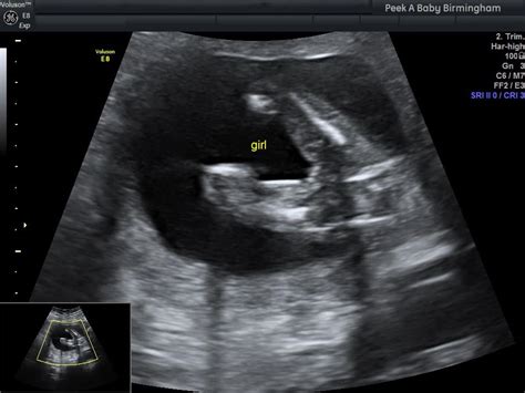 baby gender scan london  Based on 350+ reviews